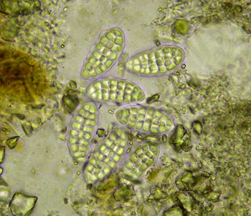 Cryptothecia randallii