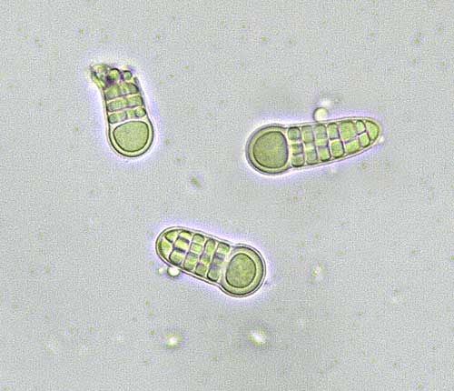 Cryptothecia submacrocephala spores