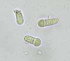 Cryptothecia submacrocephala