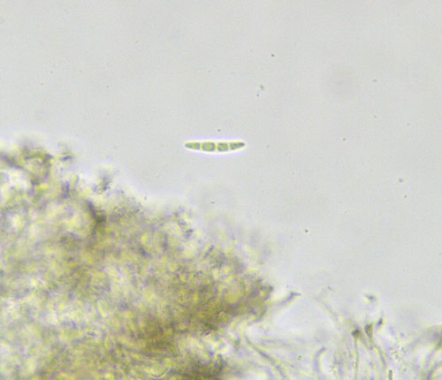 Enterographa compunctula