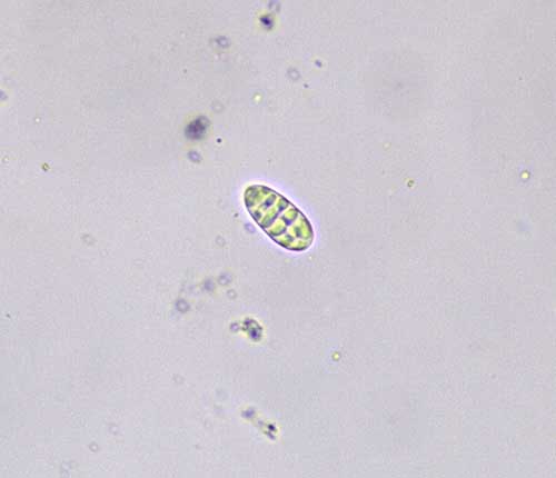 Fissurina  albolabiata