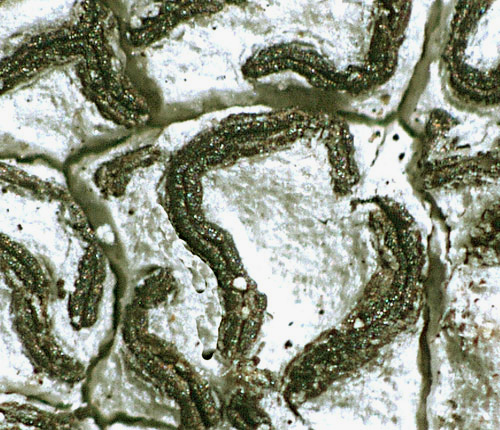 Graphis analoga