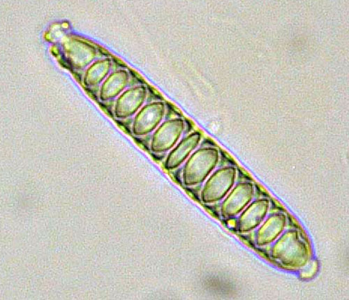 Graphis brittoniae