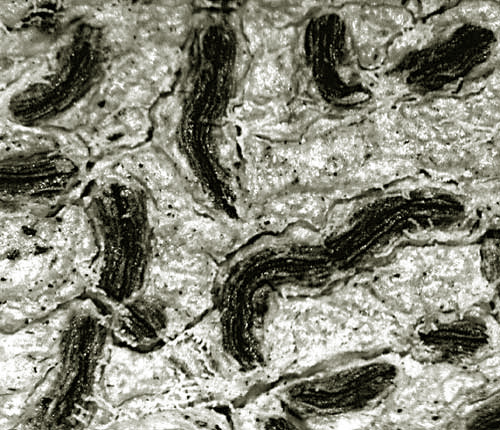 Graphis chlorotica
