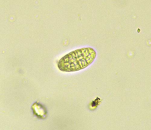 Graphis ferrugineodisca