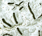 Graphis leptocarpa