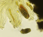 Graphis pseudoserpens