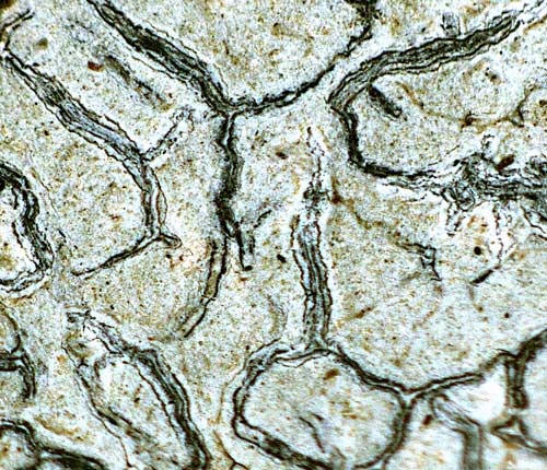 Graphis subamylacea