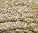 Pertusaria pycnothelioides