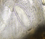 Pertusaria pycnothelioides