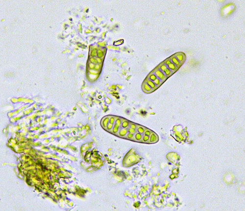 Phaeographis pseudostromatica