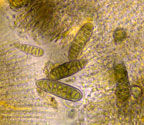 Phaeographis quadrifera