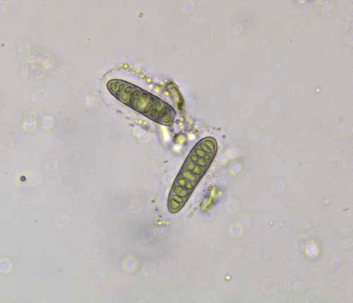 Phaeographis radiata