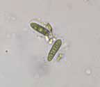 Phaeographis radiata