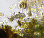Platygramme coccinea ascospores