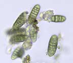 Platygramme elegantula spores