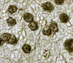 Pseudopyrenula diluta