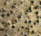 Pyrenula adacta