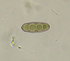 Pyrenula adacta