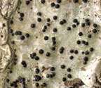 Pyrenula aspistea