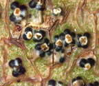 Pyrenula astroidea