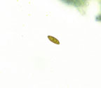 Pyrenula circumfiniens