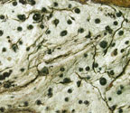Pyrenula concatervans