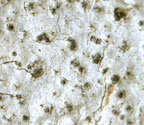 Pyrenula confinis
