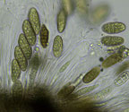 Pyrenula dissimulans spores