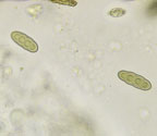 Pyrenula gahavisukana