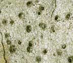 Pyrenula parvinuclea