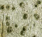 Pyrenula parvinuclea