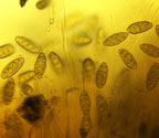 Pyrenula septicollaris spores